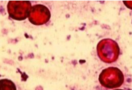 Imatge de Cryptosporidium spp. a través d’un microscopi.