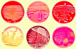 imatge-resistències