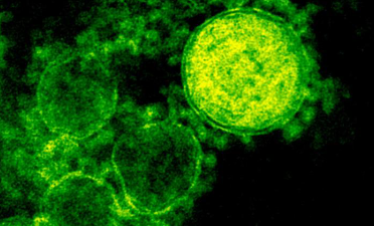 Imatge d'un coronavirus MERS elaborada per l'Institut americà d'al·lèrgies i malalties infeccioses.