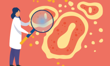 Cribratge oportunista de les infeccions sexuals per clamídia i gonococ en poblacions vulnerables des dels centres comunitaris