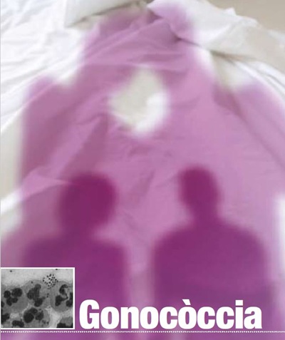 Gonococcia