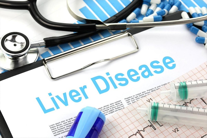 liver disease