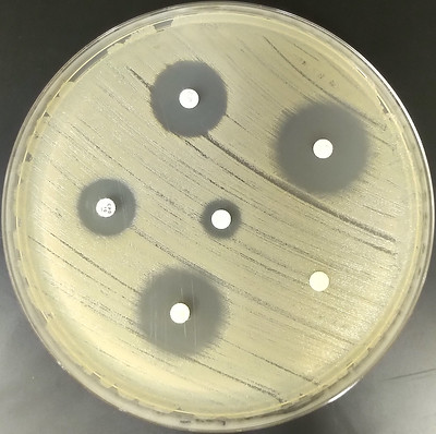 imatge cultiu bacteria